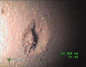 Pit image 2 Pit image 2