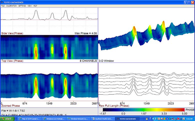 waveform